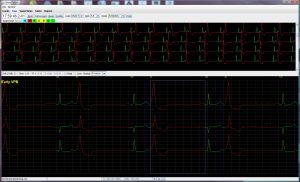 Holter LX – Basic