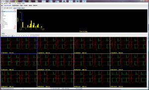 Holter LX – Enhanced