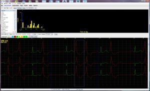 Holter LX – Enhanced Plus