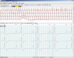 Holter LX – Pro